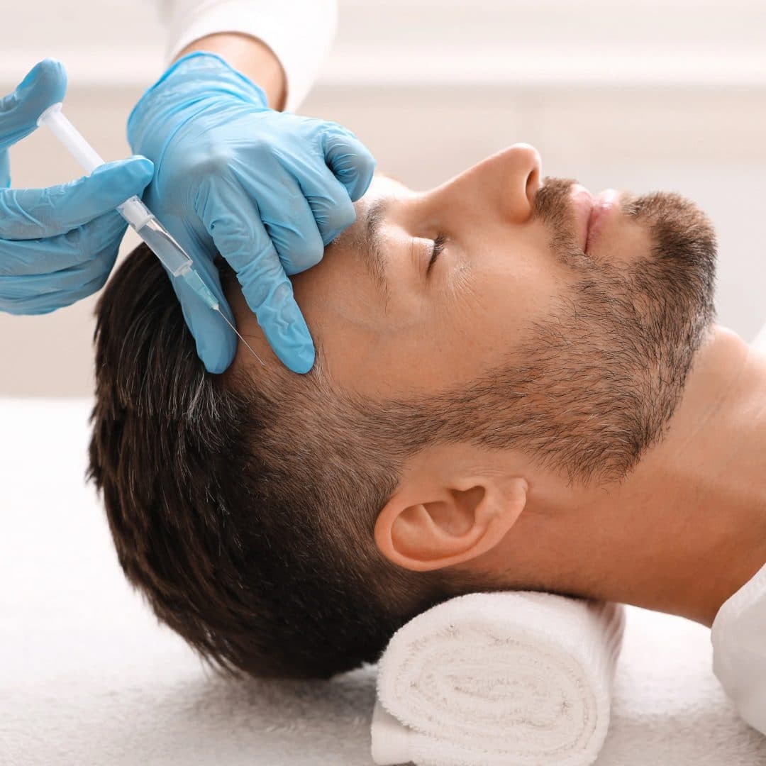 PRP Therapy