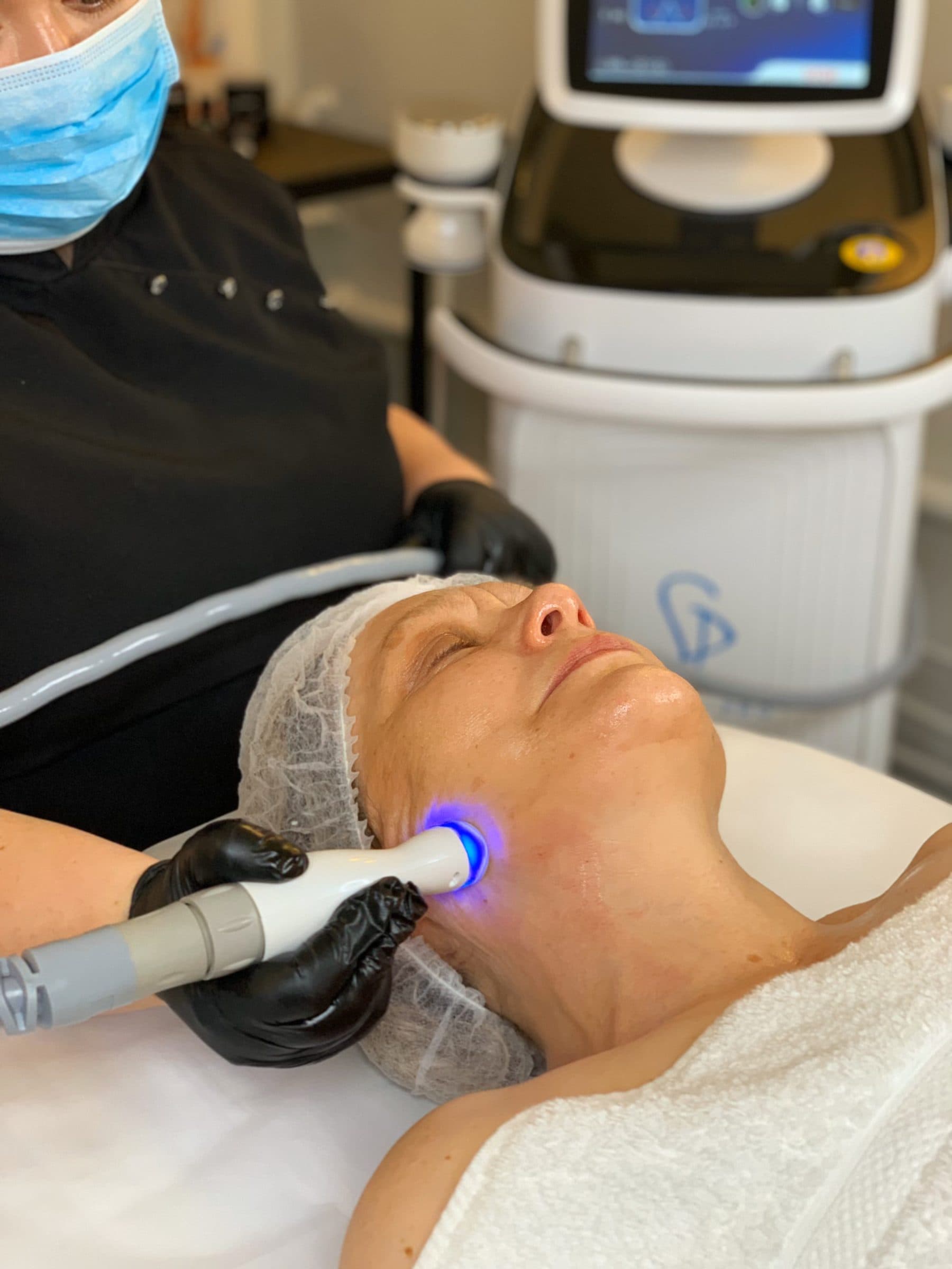 RF Skin Tightening