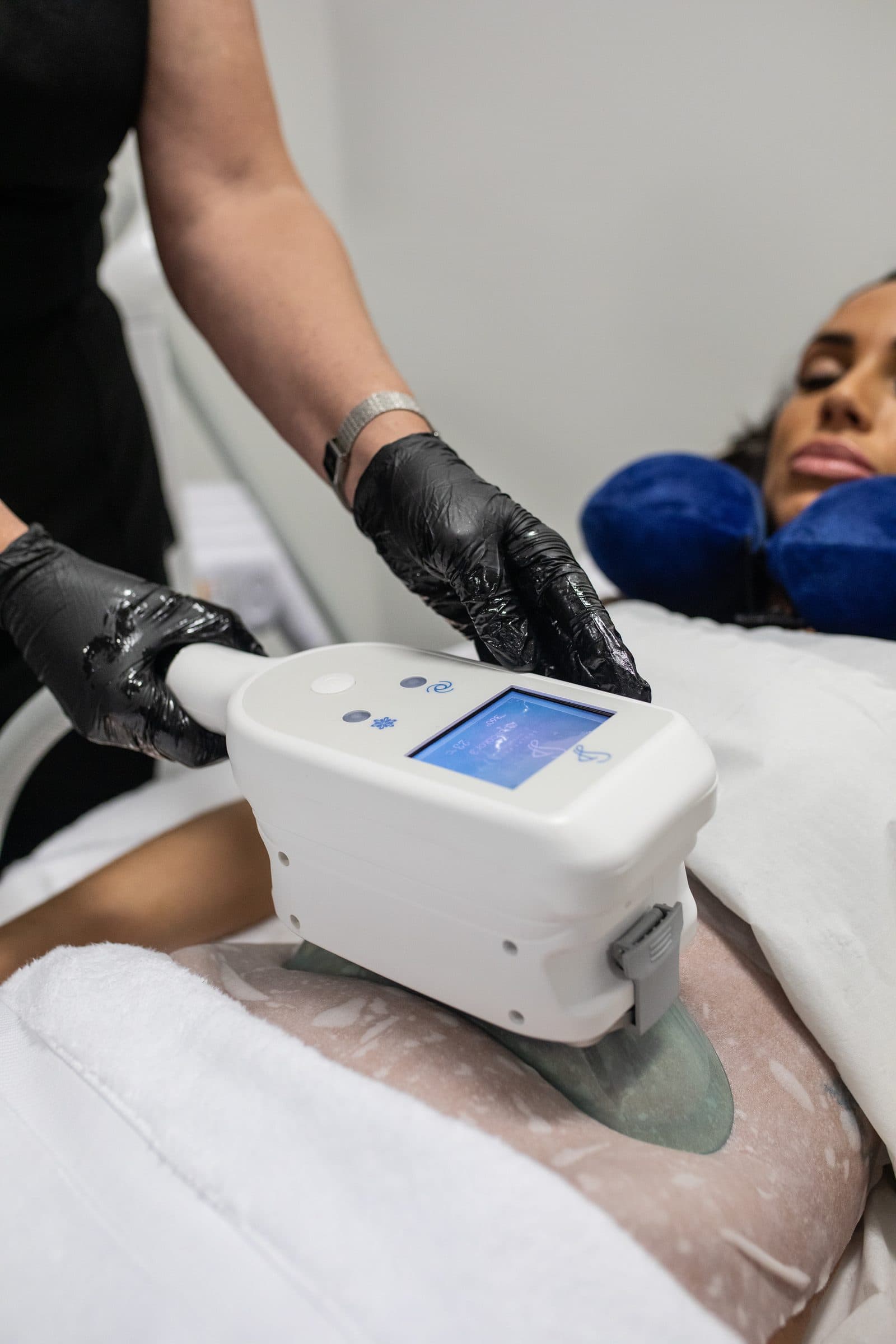 Lipo Freeze (Cryolipolysis)
