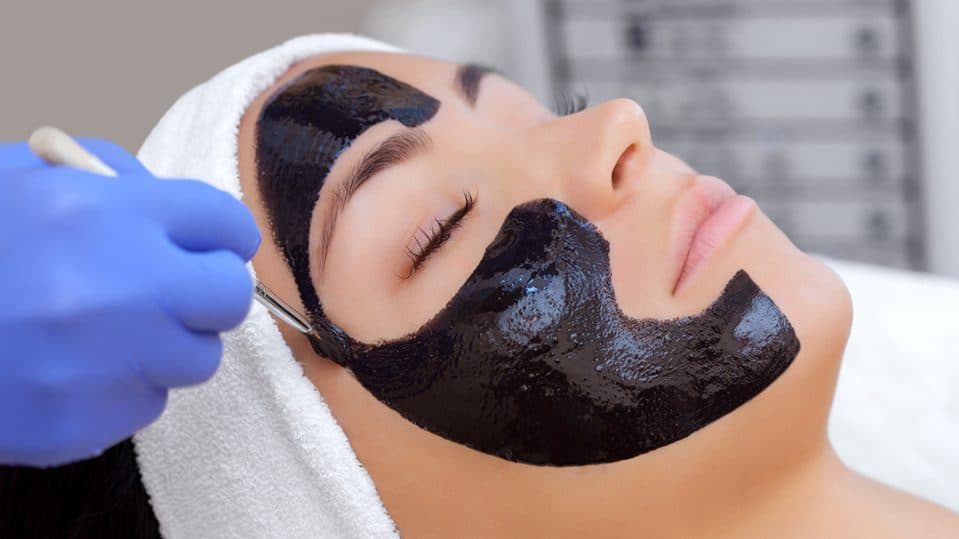 V-Carbon Peel