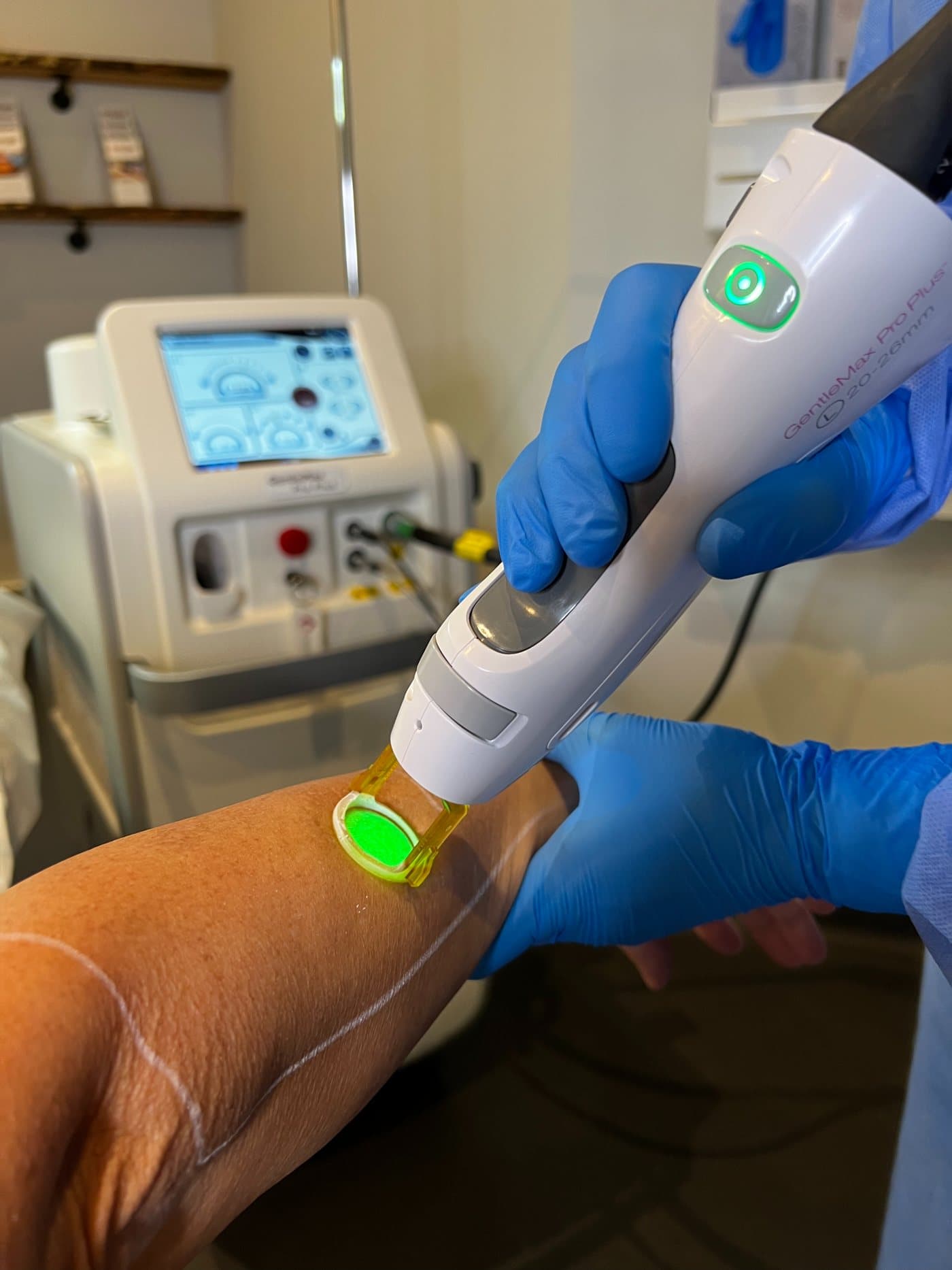 Laser treatments at Clinic C, Aberdeen